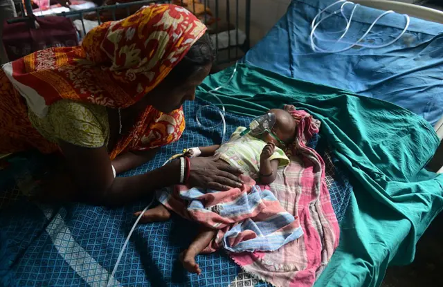  जॅपनिज एन्सिफालिटीसमुळे आजारी बालक