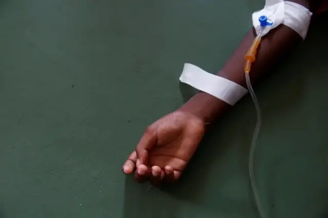 Cholera