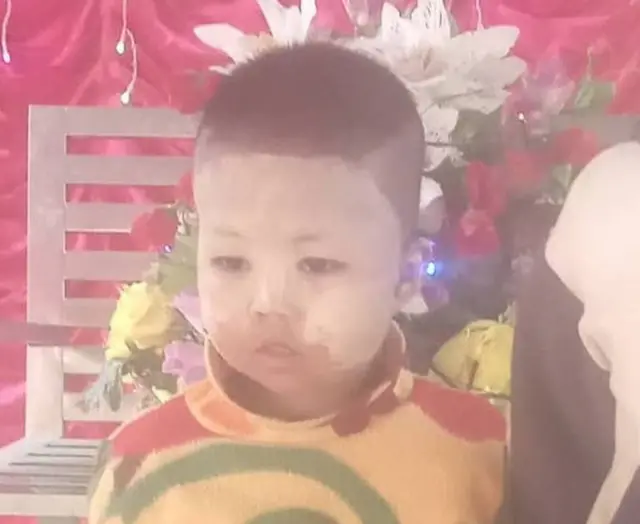 બૉમ્બમારામાં મૃત્યુ પામેલ ત્રણ વર્ષીય હનીન યુ વાઇનની તસવીર