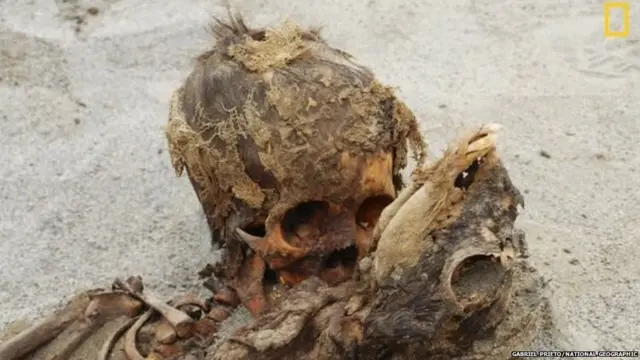 ਬੱਚਿਆਂ ਅਤੇ ਇਲੀਮਿਆਂ ਦੇ ਕੰਕਾਲ