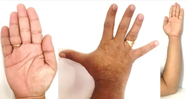 బెత్తె, జాన, మూర