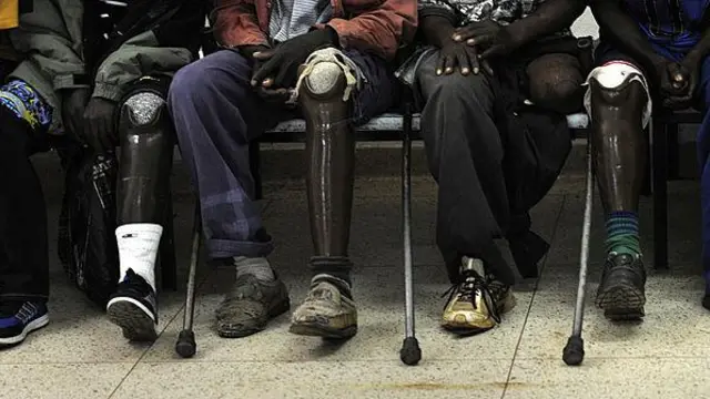 Des victimes de mines terrestres attendent de commencer la physiothérapie, le 25 mars 2009 dans une salle du centre orthopédique Agostino Neto à Huambo. Angola