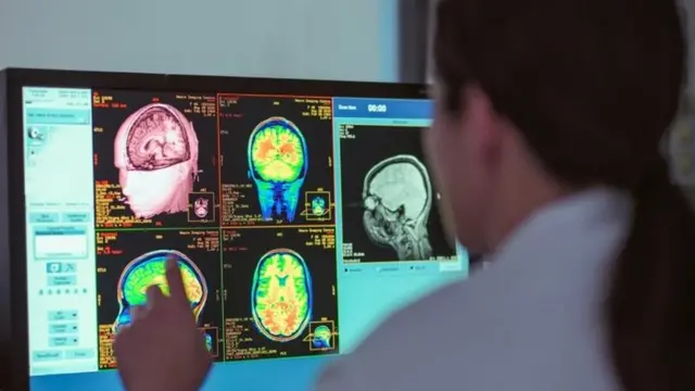 Scanners de cerveau.