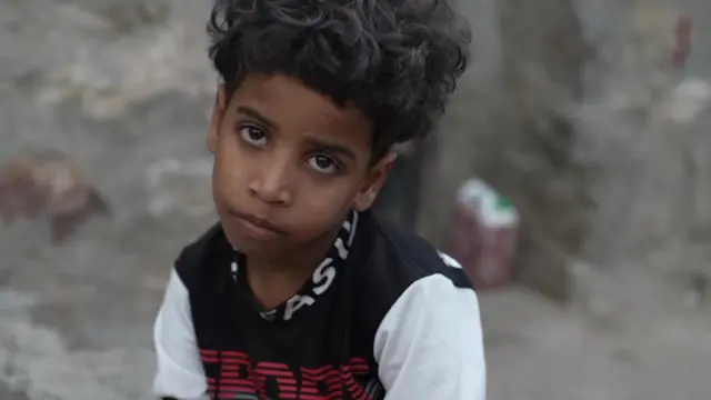 यमन की जंग में तबाह होता बचपन