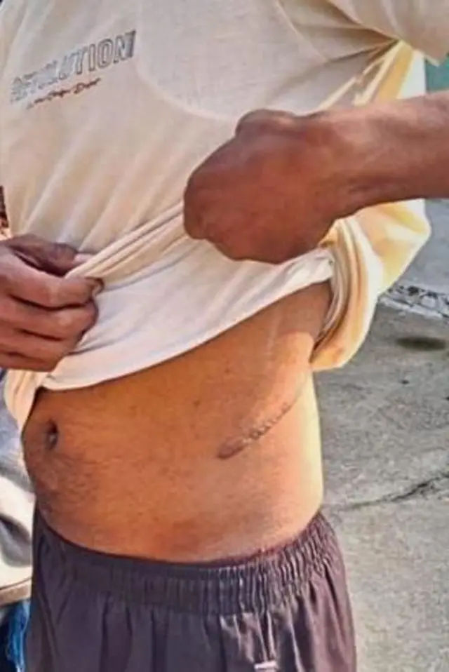 મહારાષ્ટ્ર, શાહુકારના દબાણ હેઠળ કિડની વેચી, કંબોડિયામાં કિડની વેચવાના રેકેટની તપાસ, ગરીબ ખેડૂત ધિરાણ, બીબીસી ગુજરાતી 