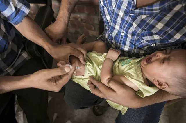 শিশুর পায়ে ইনজেকশন দেয়া হচ্ছে, শিশু কাঁদছে।