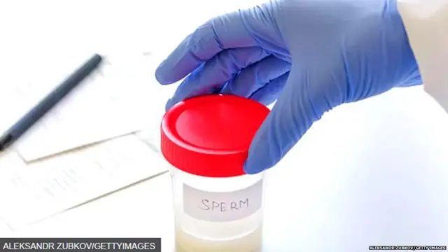 ਸ਼ੁਕਰਾਣੂ