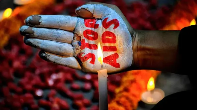 ఎయిడ్స్