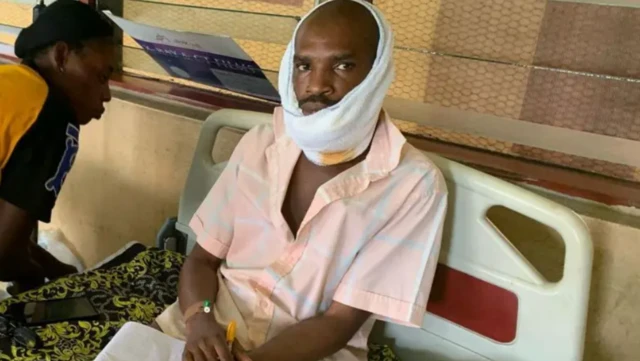 Aworan ọkunrin ti ibọn ba lẹnu