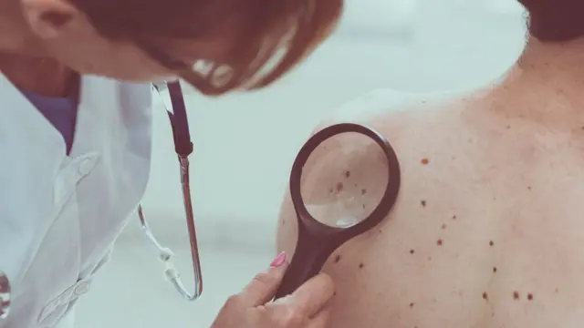 Doctora examinando examinando manchas en la espalda de un hombre joven.