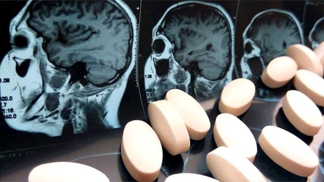 Таблетки и рентгеновский снимок мозга