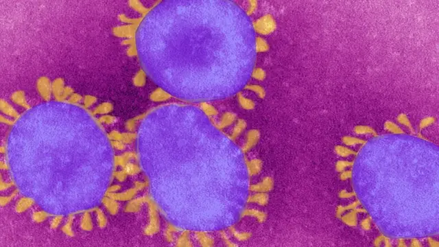 Coronavirus News: ஒரு சொகுசு கப்பல், 2 விமானங்கள், 100 மரணங்கள், 2000 ஐ- ஃபோன்கள் - இதுவரை நடந்தவை