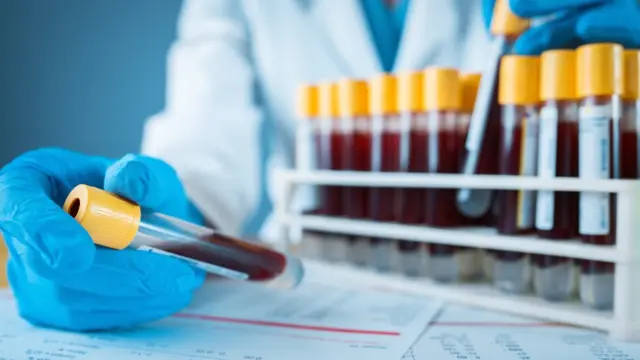 Análisis de sangre,