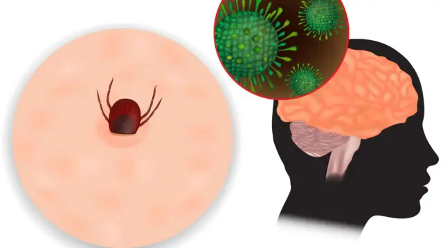 சந்திபுரா வைரஸ்