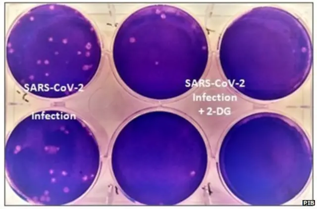 2 डीऑक्सी - डी- ग्लूकोज