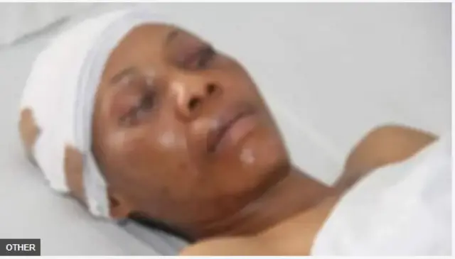 Amarachi lórí ìbùsùn ilé ìwòsàn