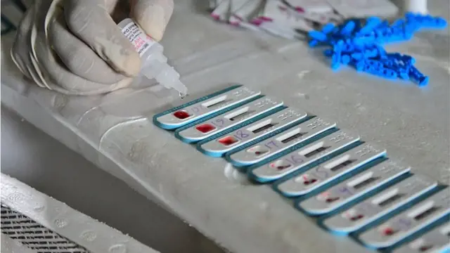 Une rupture des campagnes de prévention du fait du coronavirus pourrait entraîner plus de 500.000 morts supplémentaires en Afrique sub-saharienne sur une année entre 2020 et 2021.