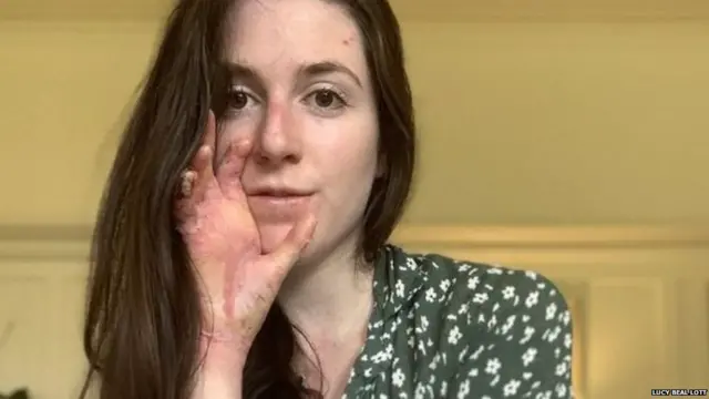 ਲੂਸੀ ਬੀਲ ਲੋਟ