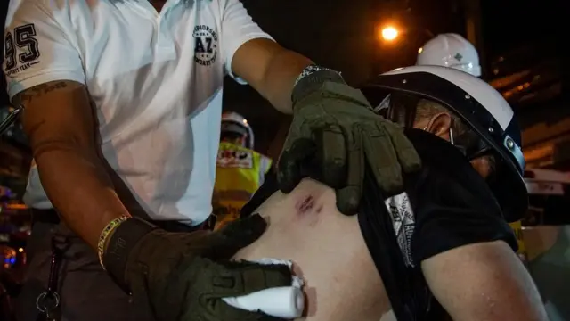 ภาพคนบาดเจ็บที่หลัง