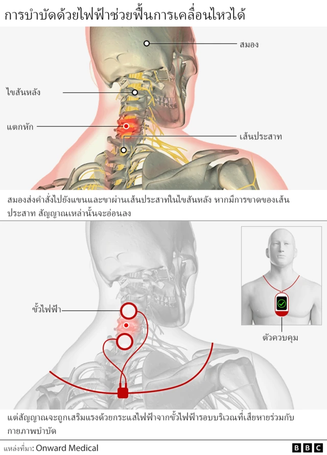 กราฟฟิค
