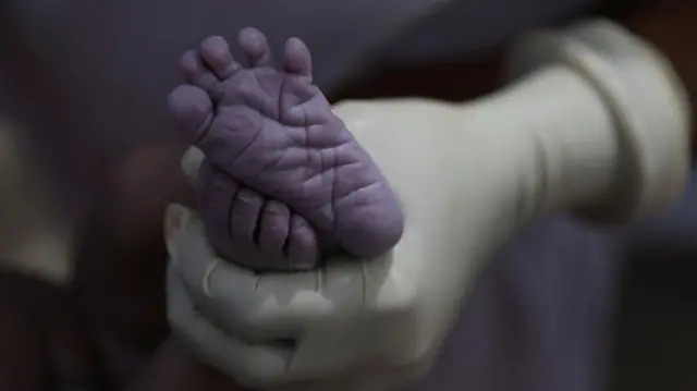 갓 태어난 신생아의 발바닥