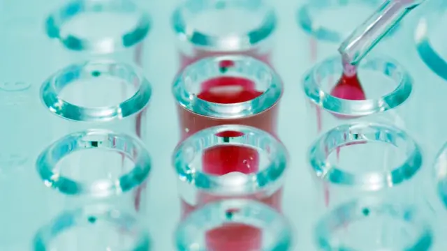Muestras de laboratorio.