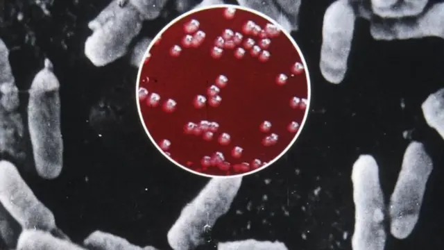 புபோனிக் பிளேக் என்றால் என்ன?