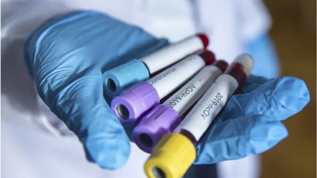 Ayẹwo ẹjẹ fun coronavirus