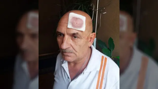 Під фото, які поширили у соцмережах, вказувалося, що так Володимир Цемах виглядав після затримання