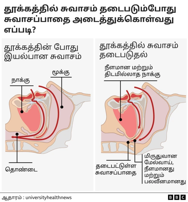 குறட்டை