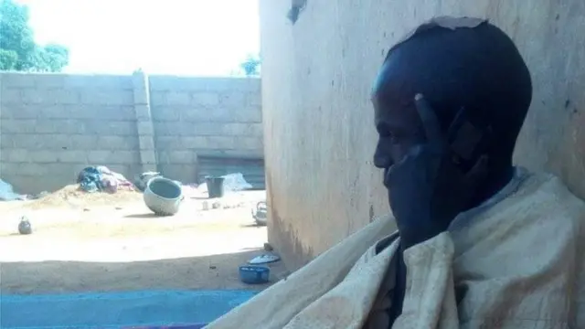 Anoda broda to di minister suffer broken leg and dem also break im head with beatings
