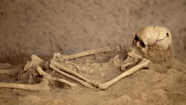 هيكل عظمي تبدو عليه بوضوح أثار عملية ثقب الجمجمة