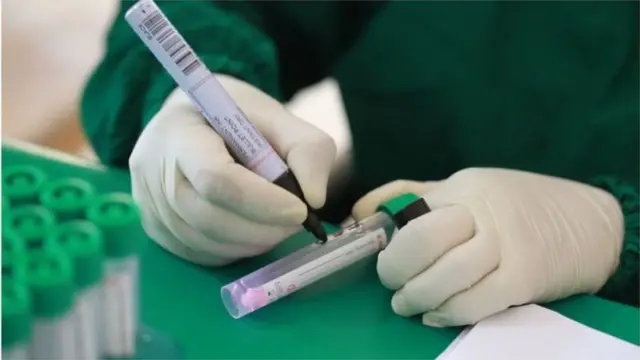 সর্বোচ্চ ৩০ মিনিটে ফল পাওয়া যাবে।