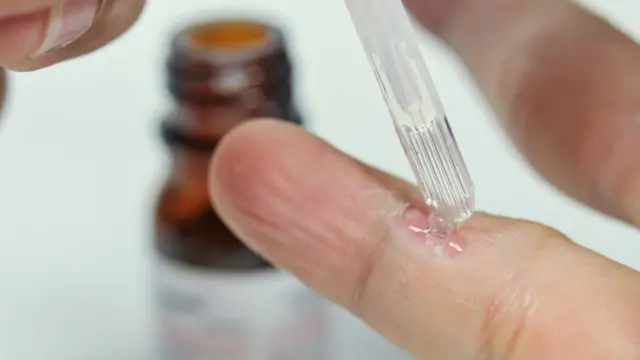 Persona echándose ácido salicílico en un dedo