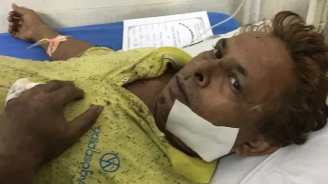 हमले में घायल यात्री