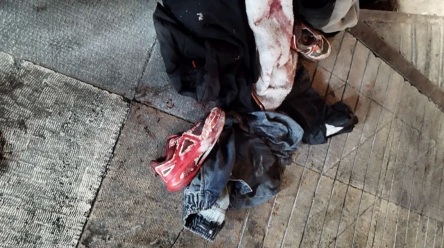 عکس یک کفش سفیدرنگ آغشته به خون و لباس‌هایی خونین را نشان می‌دهد