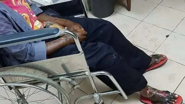 Luka-luka yang diderita Adelina.