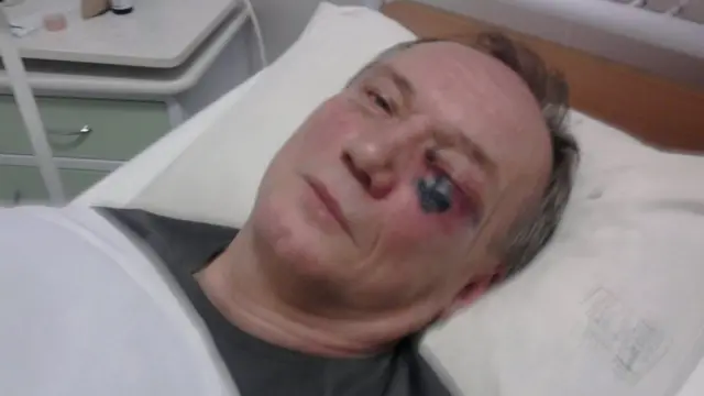 Поэт Владимир Некляев