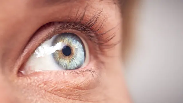 Ojo