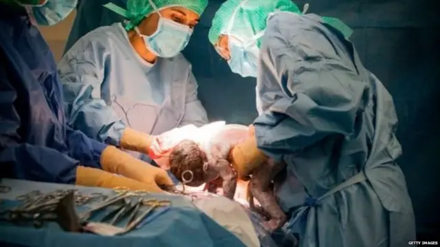 ਬੱਚੇ ਨੂੰ ਜਨਮ ਦਿਵਾਉਂਦੇ ਡਾਕਟਰ