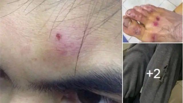 పోలీసుల దాడిలో గాయపడిన ఎర్లీ రెయిన్ చర్చి సభ్యులు