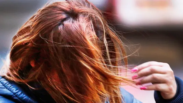 ผมบนศีรษะ