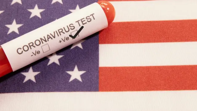 Testevbet kayıp bonusucoronavírus com a bandeira dos Estados Unidos