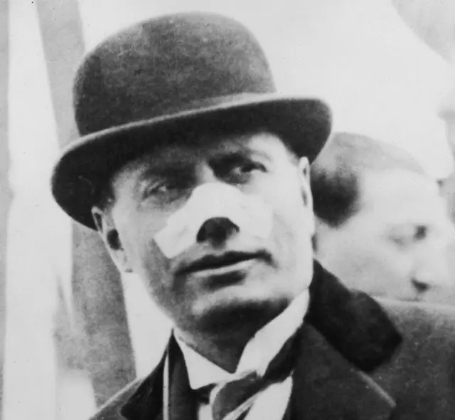 Mussolini oo uu ka muuqdo dhaawicii xabbadda
