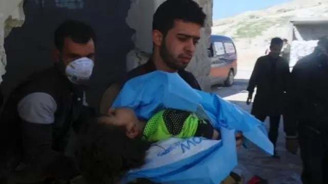 सीरिया में रासायनिक हमले में घायल बच्चा