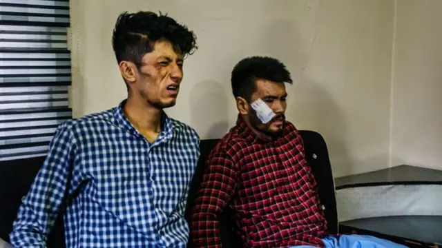 الصحفيان الجريحان تقي دريابي (يسار) ونعمة الله نقدي