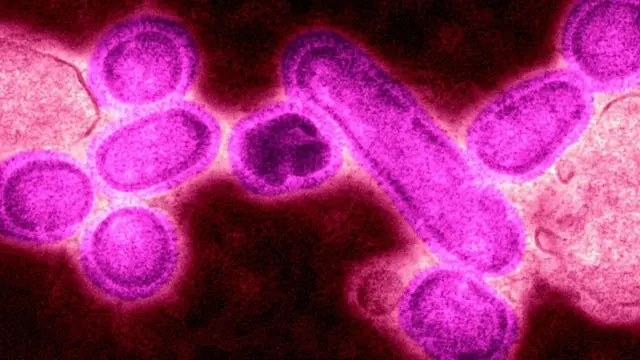 صورة لأحد أشكال فيروس الأنفلونزا