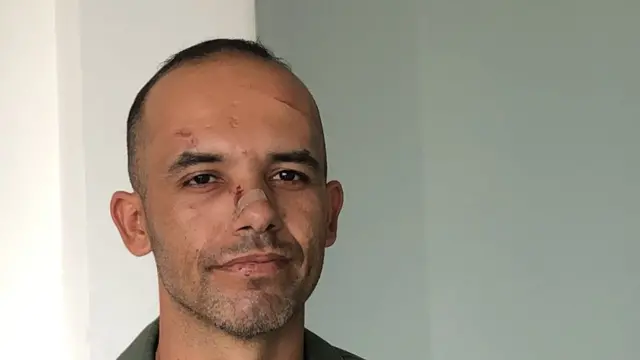 Sargento con heridas