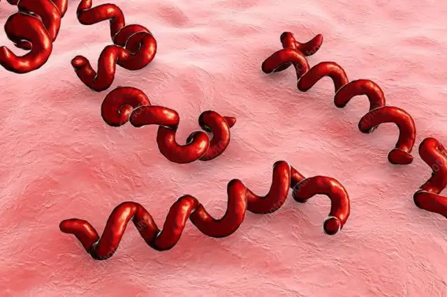 ซิฟิลิส