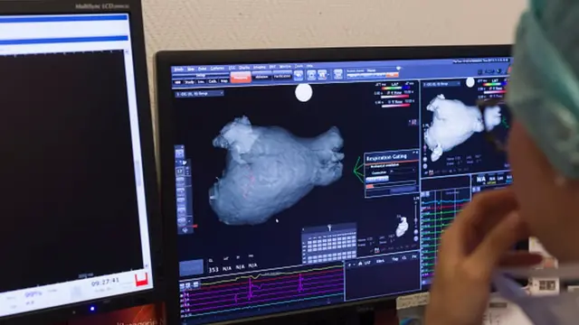 Коронавирус может вызывать повреждение сердечной мышцы и тромбы в крови